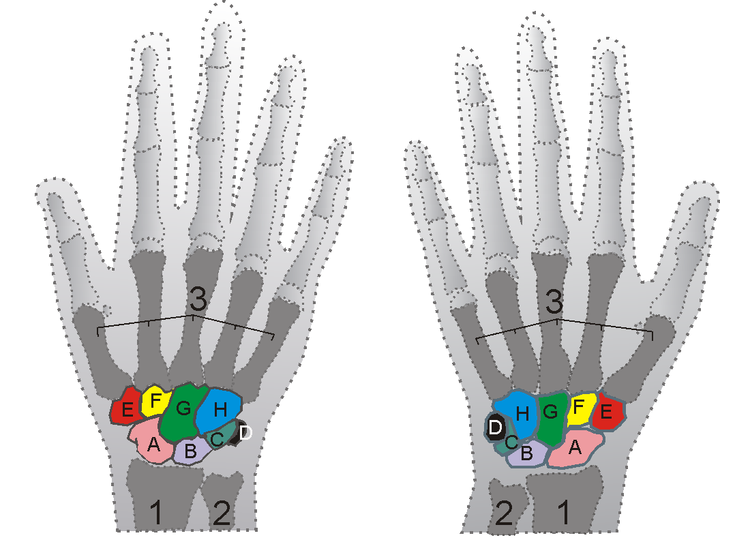 Squelette des mains droite et gauche. 1-radius ; 2-ulna ; 3-métacarpiens ; A-scaphoïde ; B-lunatum ; C-triquetrum ; D-pisiforme ; E-trapèze ; F-trapézoïde ; G-capitatum ; H-hamatum. © Zoph, Wikimedia, CC by-sa 3.0