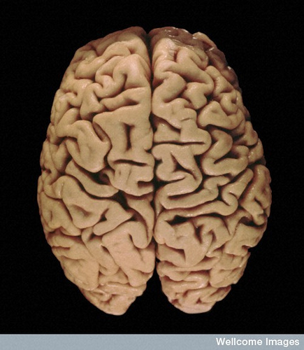 Le cerveau est un site de privilège immun.&nbsp;© Wellcome Images, Flickr, cc by nc nd 2.0