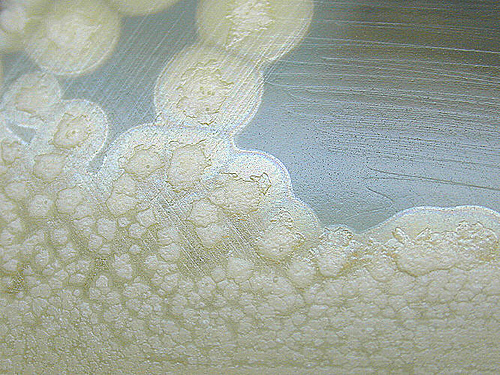 Clostridium botulinum produit des toxines responsables du botulisme. © hukuzatuna, Flickr, CC by-nc-nd 2.0