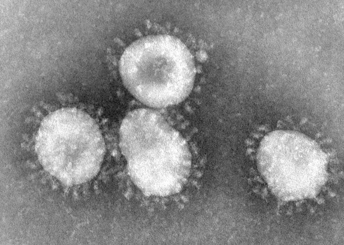Le SARS-CoV (visible ici au microscope électronique à transmission) est un Coronavirus. © DR