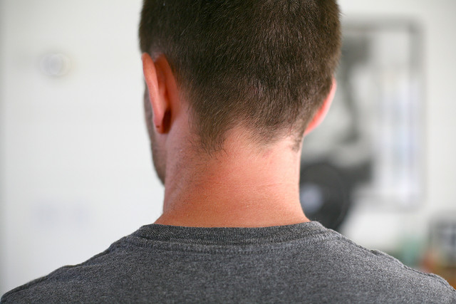 Les hernies cervicales se produisent au niveau des vertèbres du cou et peuvent entraîner une douleur si elles compriment un nerf. © numberstumper, Flickr, cc by sa 3.0
