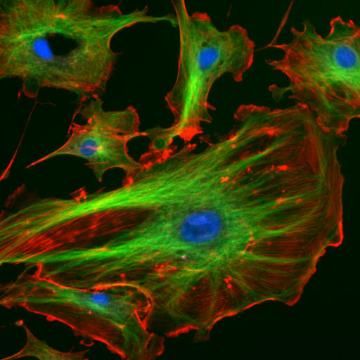 Les éléments du cytosquelette peuvent être marqués à l'aide de protéines fluorescentes. Ici l'actine est en rouge, les microtubules en vert (et le noyau en bleu). © DR