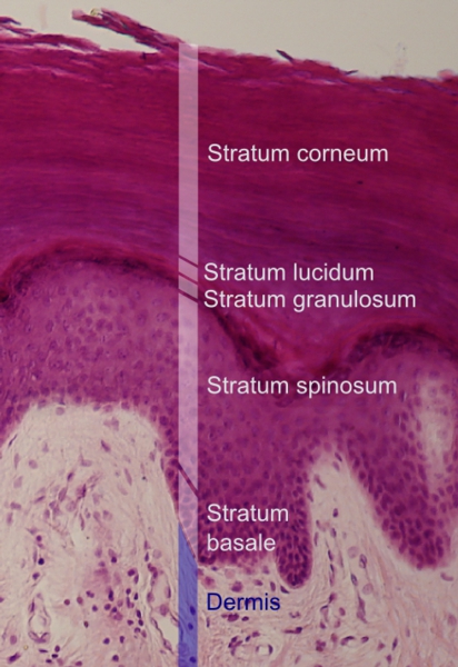 L'épiderme se compose de cinq couches, avec la stratum corneum dans la position la plus externe. © Mikael Häggström, Wikipédia, cc by sa 3.0