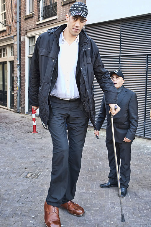Sultan Kösen est l'homme le plus grand du monde, avec 2,51 m. Né en Turquie en 1982, il est atteint de gigantisme. Sa croissance anormale résulte d'une tumeur affectant son hypophyse. © Amsterdamman, cc by sa 3.0