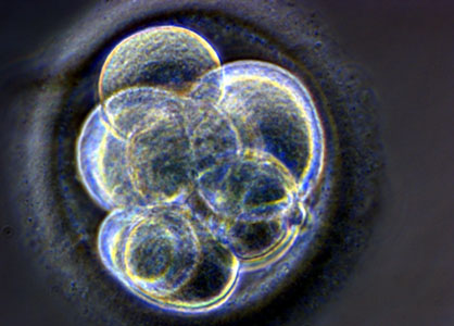Le tératome peut se former à partir de cellules apportées par des cellules souches. © sante-decouverte