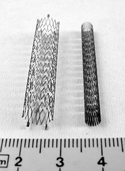 Un stent est une endoprothèse métallique cylindrique. © Franck C. Müller, Wikimedia, CC by-sa 2.5