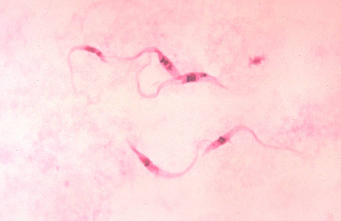 Le trypanosome, que l'on voit ici, cause une célèbre parasitose mortelle si elle n'est pas traitée : la maladie du sommeil. © Centers for Disease Control and Prevention, Wikipédia, DP