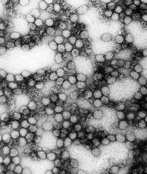 Le virus Amaril, observé ici au microscope électronique à transmission, cause la fièvre jaune. © DR