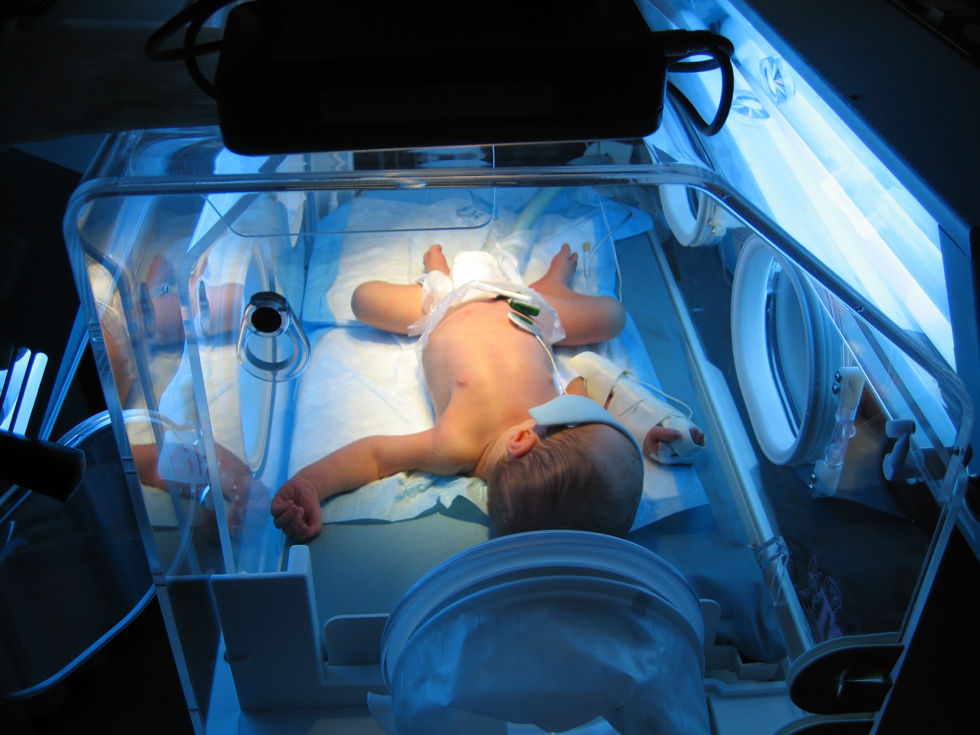 L'ictère du nourrisson se traite par photothérapie. © Jennifer Pack, Flickr, CC by-nc 2.0