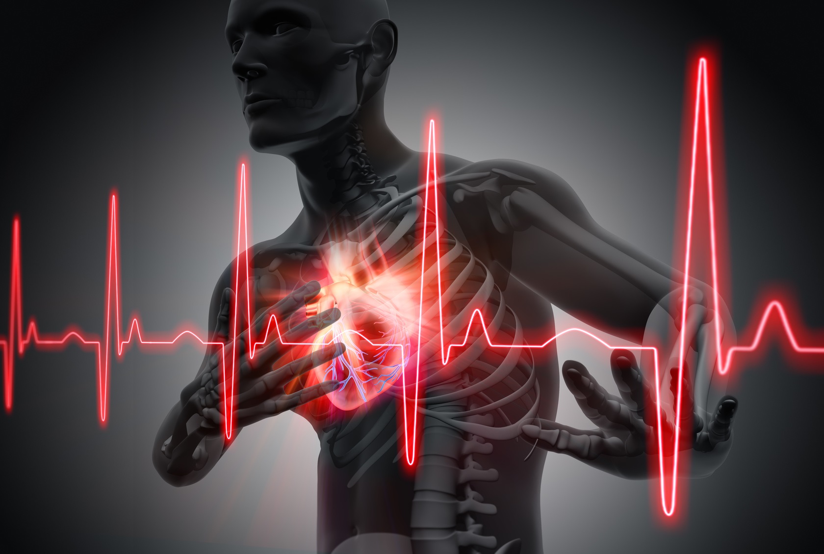 L'insuffisance cardiaque : un syndrome clinique pouvant entraîner une diminution du débit cardiaque. © Peterschreiber.media, Fotolia