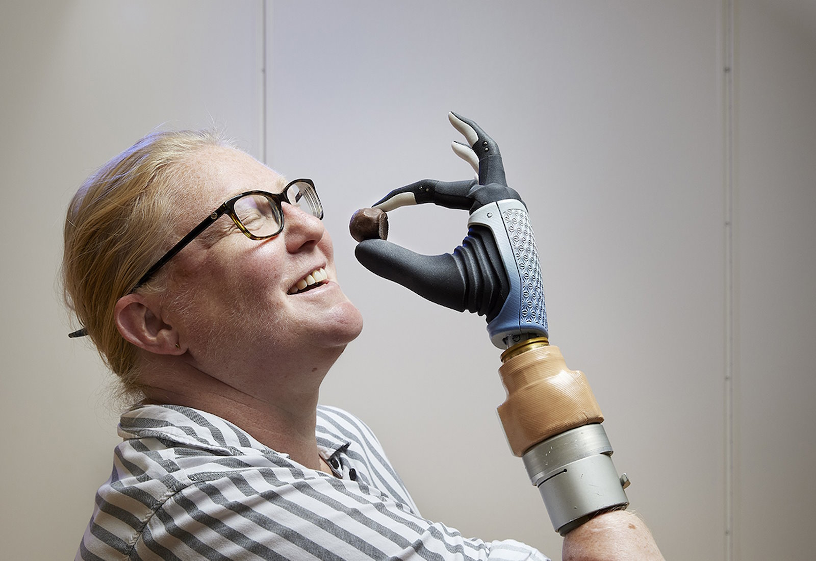 Karin, une patiente suédoise qui porte une main bionique depuis trois ans. © Ortiz-Catalan et al., Sci. Rob., 2023