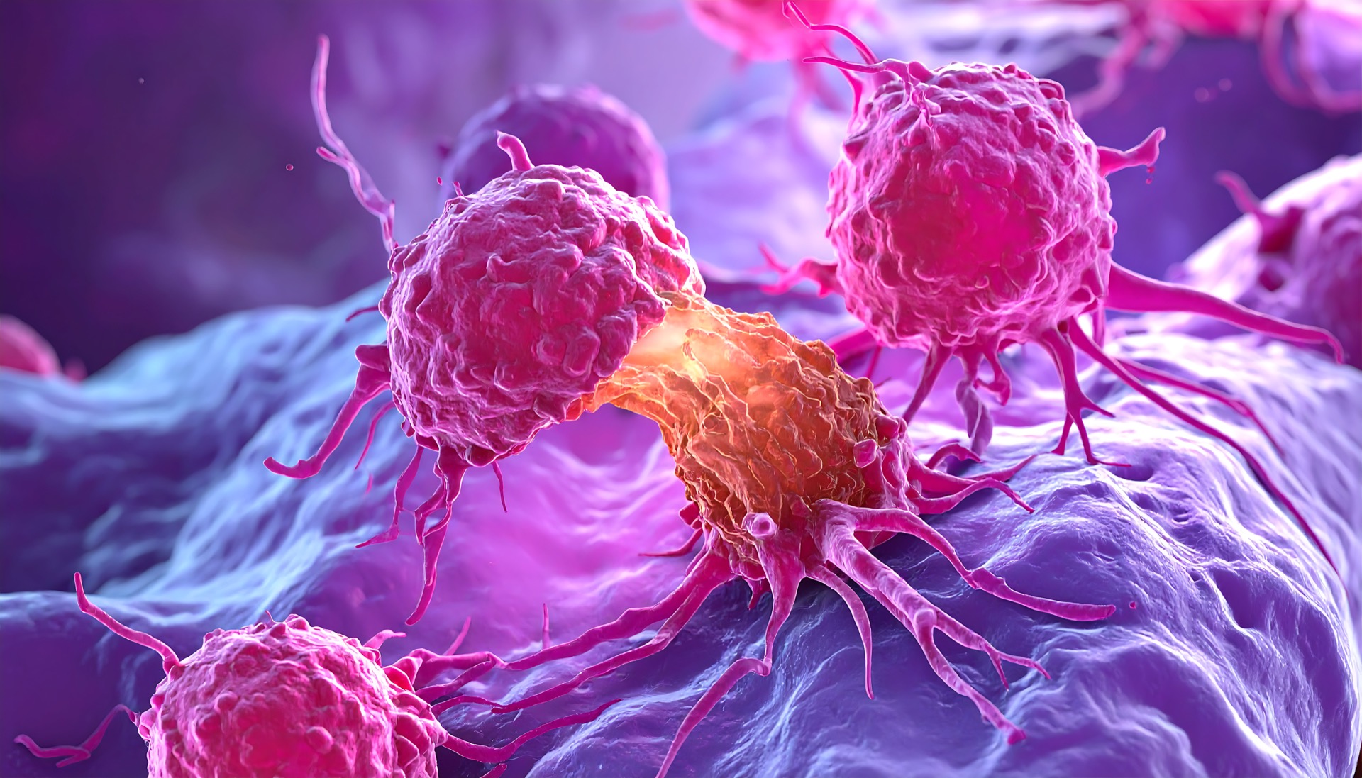 Les métastases : quand le cancer s’étend et change la donne. © Sam Adobe Stock