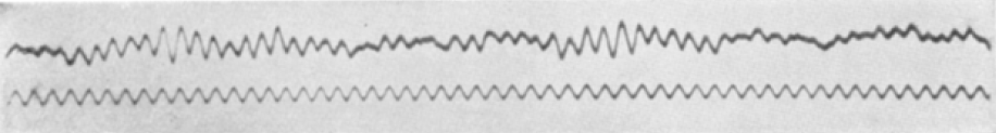 

Le premier EEG, tel qu'il a été&nbsp;enregistré par Hans Berger publié en 1929.&nbsp;©&nbsp;Domenico Forastiere, Wikimedia