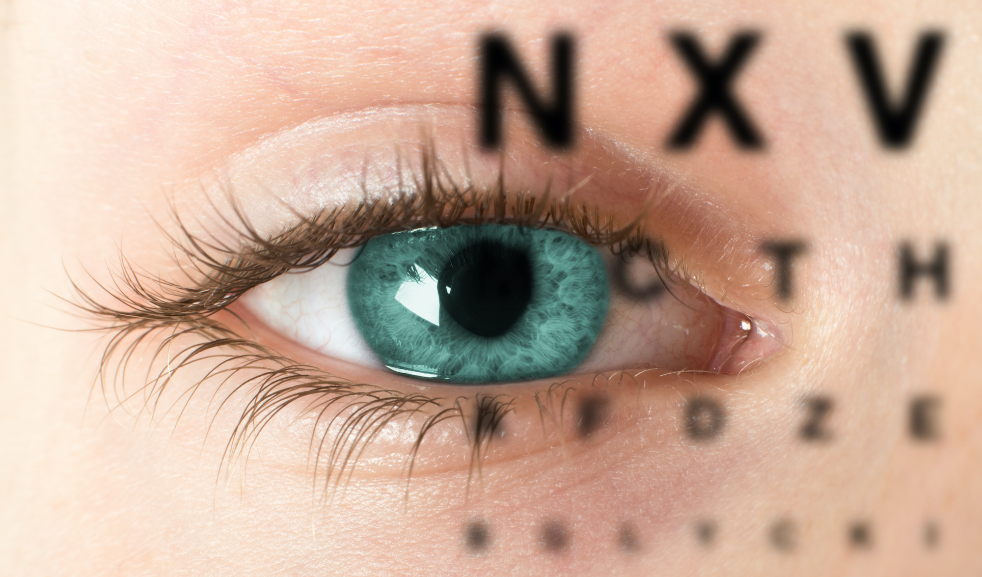 L’astigmatisme induit une vision floue des contours et des lettres. © max dallocco, Adobe Stock