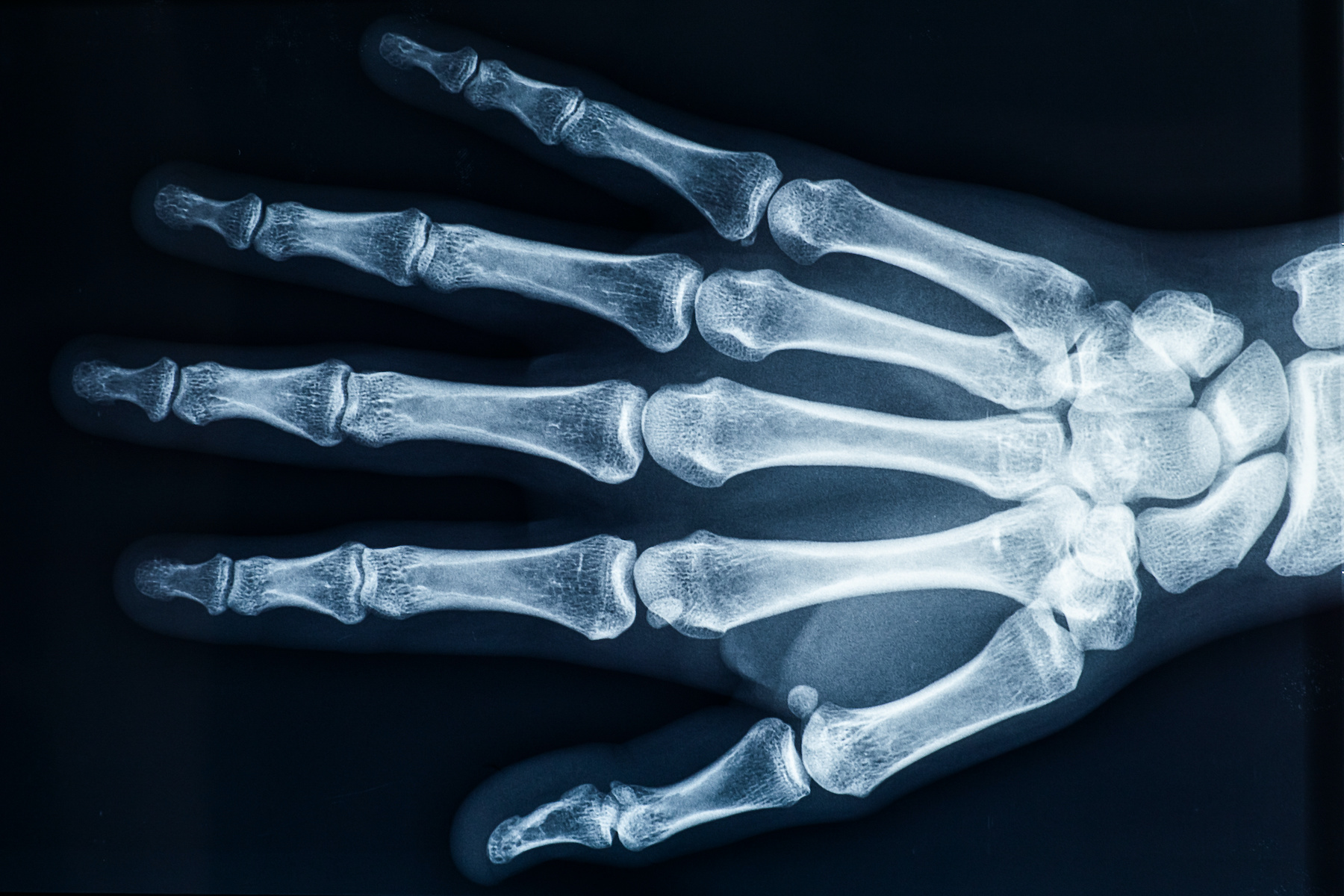 Le squelette de la main compte 27 os. © Matthieu, Adobe Stock