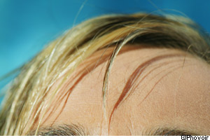 Lors d'une pelade, des cheveux ou des poils peuvent tomber brutalement. © Phovoir