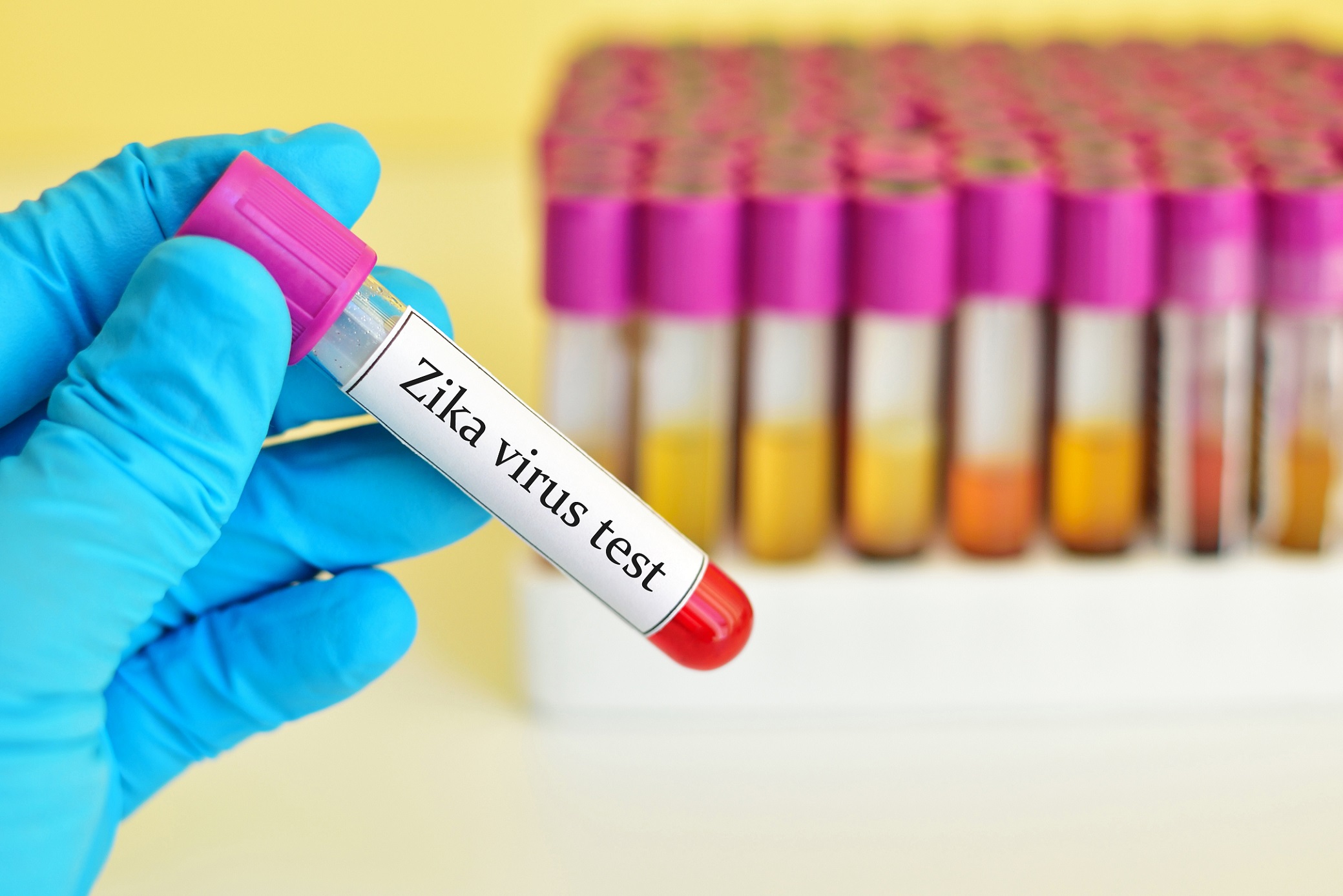 Des tests de dépistage du virus Zika existent déjà, mais ils le confondent parfois avec celui de la dengue ou du Nil occidental. © Jarun Ontakrai, Shutterstock