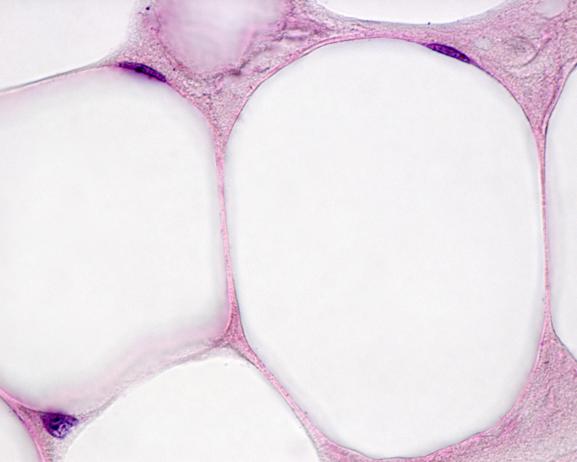 Dans les adipocytes du tissu adipeux blanc, le noyau est repoussé sur le bord à cause d'une&nbsp;grosse goutte de graisse. © Jose Luis Calvo, Shutterstock