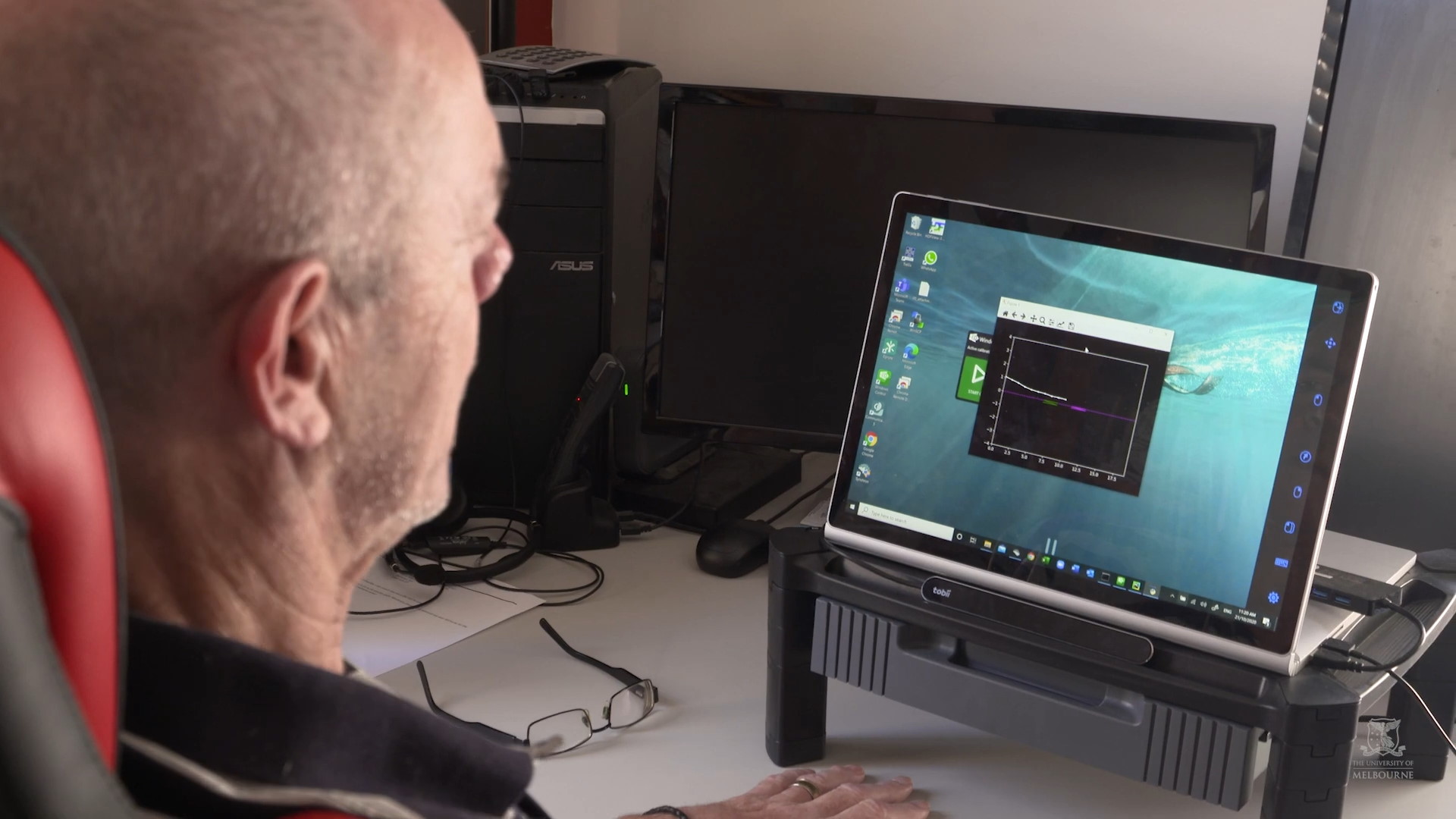Grâce à l’implant cérébral Stentrode, cet homme parvient à contrôler un ordinateur par la pensée. © Université de Melbourne