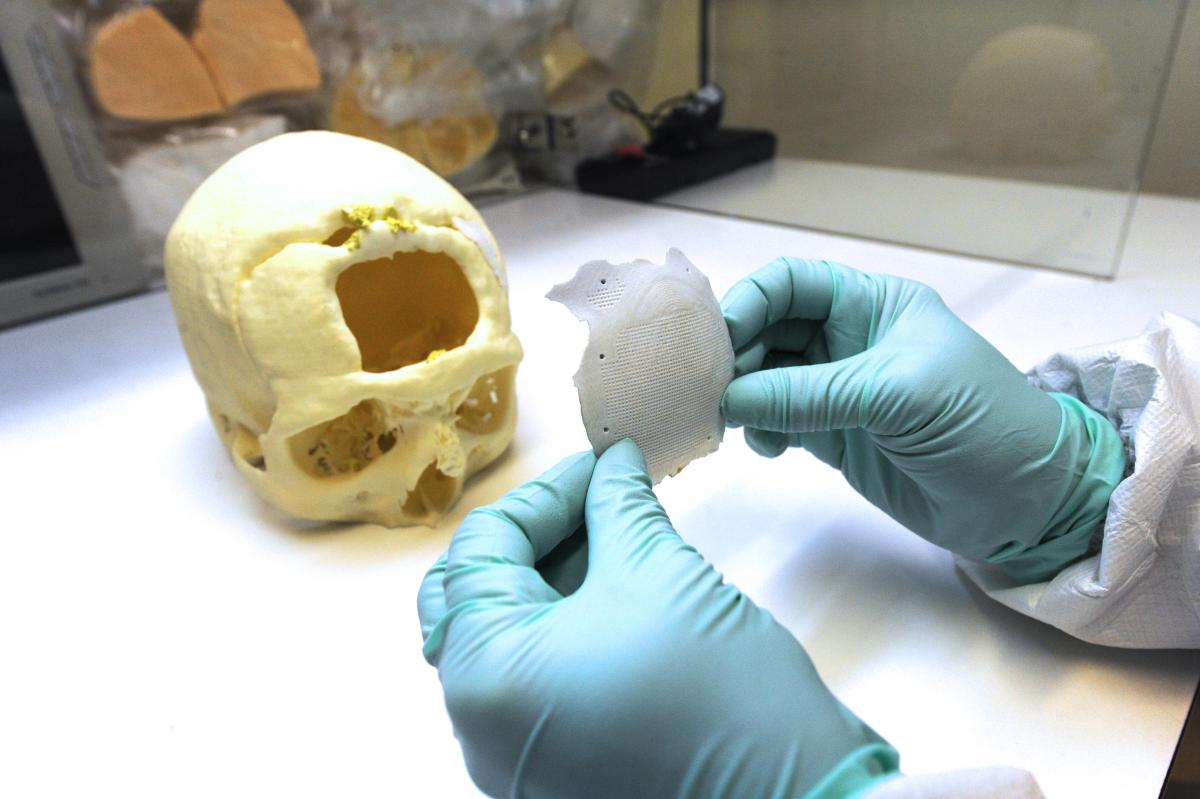 En s’appuyant sur la stéréolithographie, l'entreprise 3D Céram a développé un procédé exclusif de fabrication d'implants crâniens sur mesure en céramique hydroxyapatite. Ils sont notamment utilisés en chirurgie reconstructrice pour les patients porteurs, ou susceptibles d’être porteurs, d’une perte de substance osseuse crânio-faciale, après un acte chirurgical. Les implants en céramique sont une alternative aux greffons osseux qui proviennent bien souvent du patient lui-même, et lui évitent ainsi des douleurs supplémentaires. © AFP, Pascal Lachenaud, 3D Céram