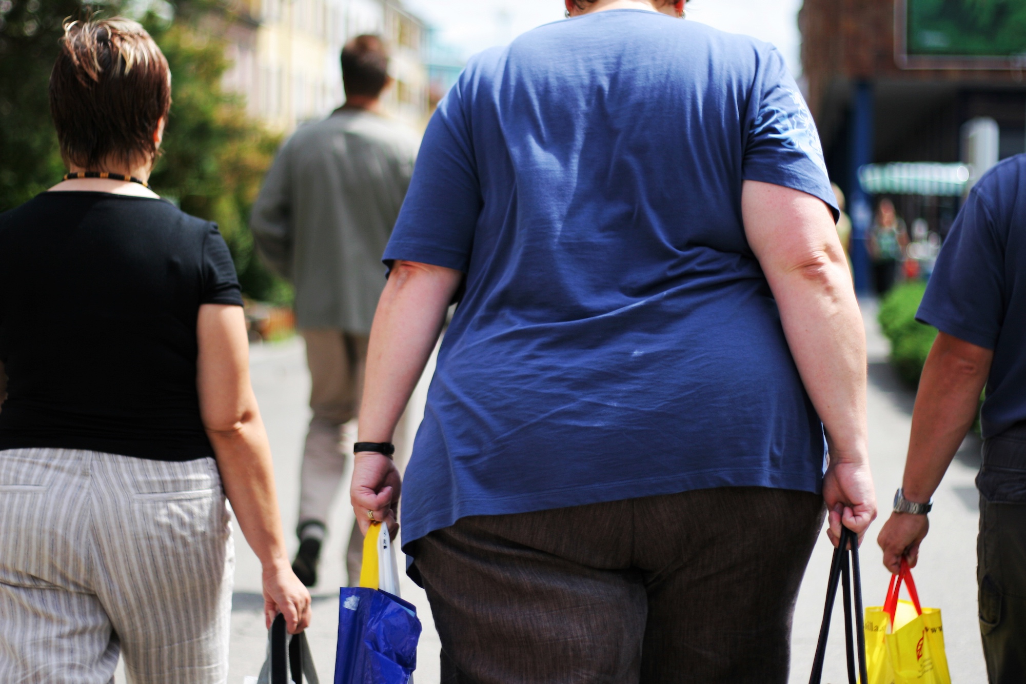 L'obésité est un facteur de risque connu de la maladie à Covid-19.&nbsp;© Jakub Cejpeck, Shutterstock