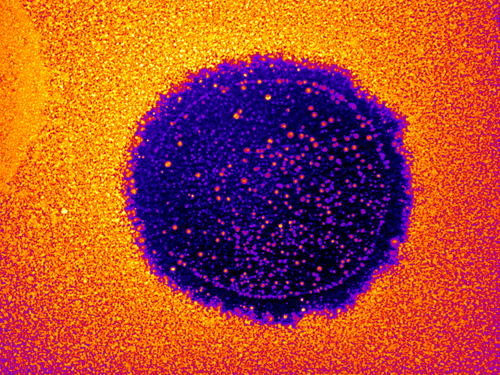 Inhibition de P. aeruginosa PAO1 par le virus bacteriophage LUZ19. Les images ont été prises en utilisant la fluorescence naturelle de P. aeruginosa à 385 nm et un grossissement x4. © Alex Betts