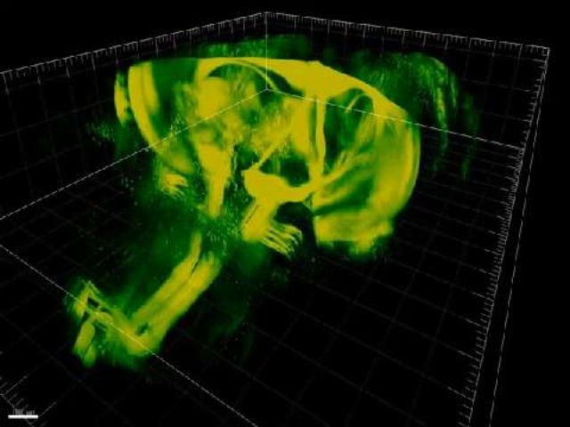 Une plongée en 3D à l’intérieur du cerveau