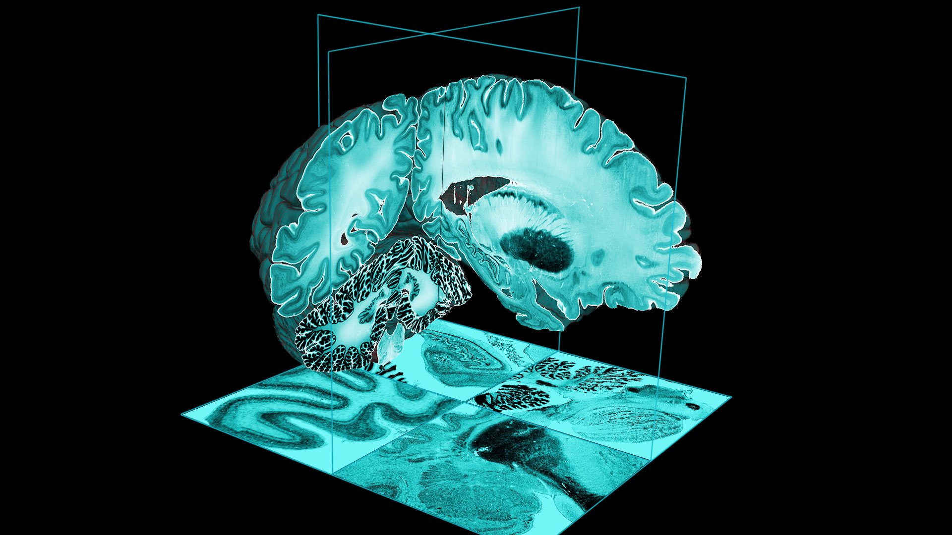 BigBrain, l’atlas 3D haute résolution du cerveau humain